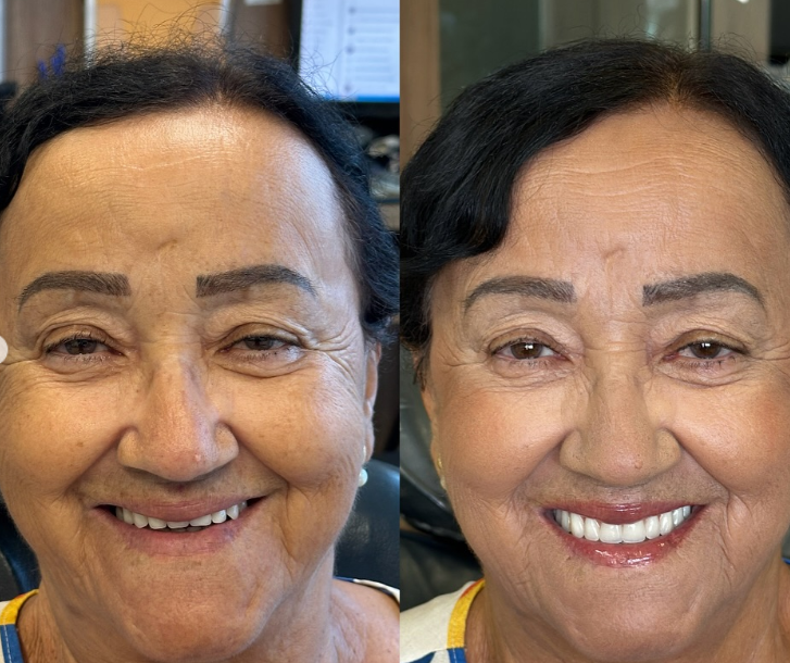 Antes e depois — procedimento 3